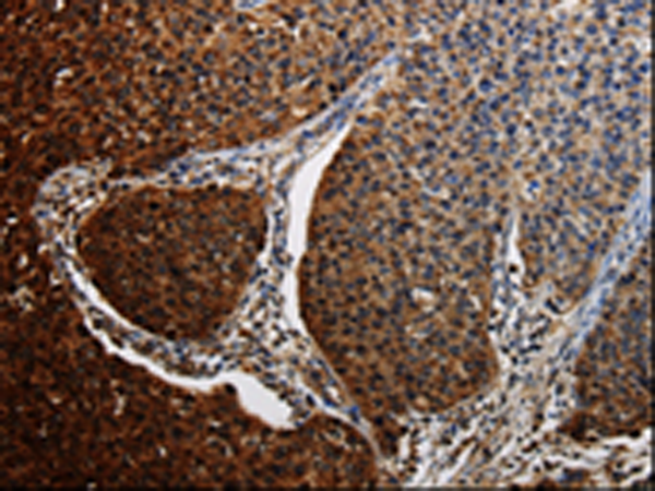 Anti-Bid Rabbit Polyclonal Antibody
