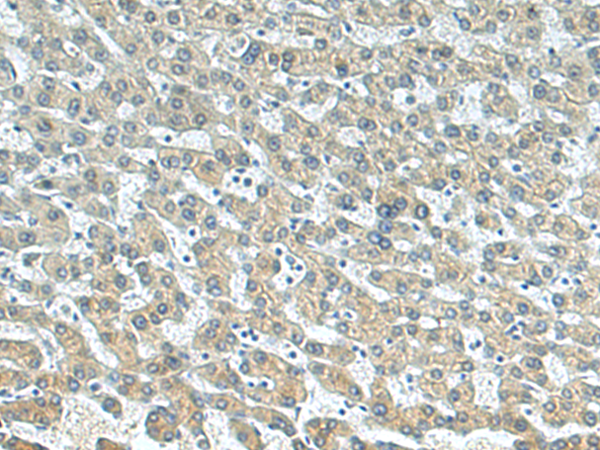 Anti-BTG3 Rabbit Polyclonal Antibody
