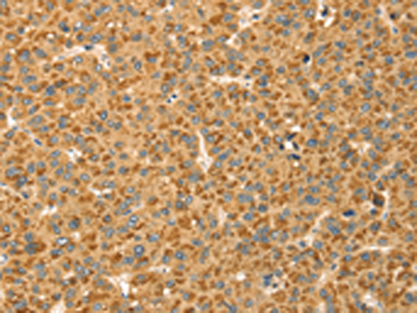 Anti-CAPN7 Rabbit Polyclonal Antibody
