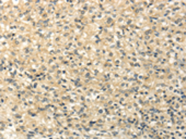 Anti-CAMK1G Rabbit Polyclonal Antibody