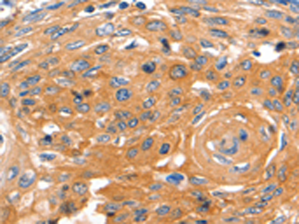 Anti-CAP2 Rabbit Polyclonal Antibody