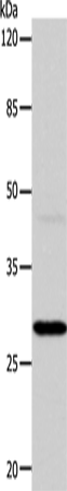 Anti-Carbonic Anhydrase 1 Rabbit Polyclonal Antibody
