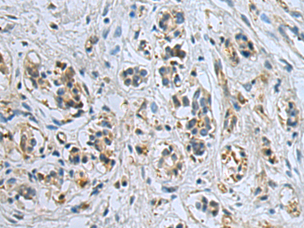 Anti-Carbonic Anhydrase 3 Rabbit Polyclonal Antibody