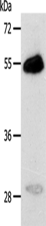 Anti-Carbonic Anhydrase 14 Rabbit Polyclonal Antibody