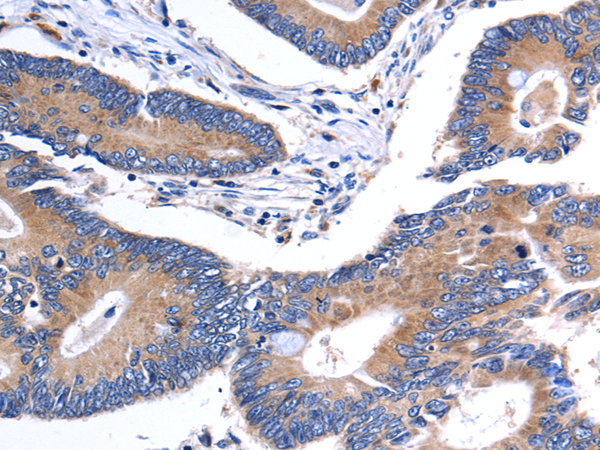 Anti-Carbonic Anhydrase 4 Rabbit Polyclonal Antibody