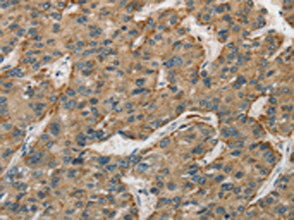 Anti-CTSE Rabbit Polyclonal Antibody