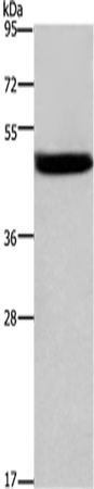 Anti-CTSE Rabbit Polyclonal Antibody