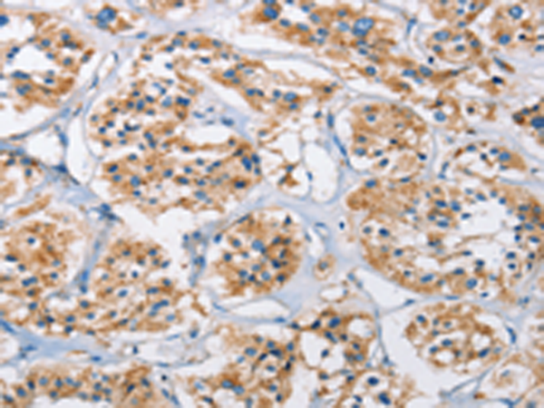 Anti-Cathepsin L Rabbit Polyclonal Antibody