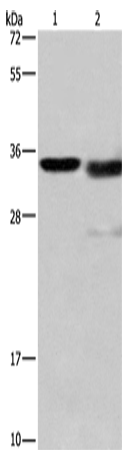 Anti-Cathepsin L Rabbit Polyclonal Antibody