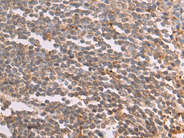 Anti-Cathepsin Z Rabbit Polyclonal Antibody