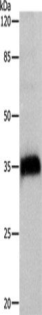 Anti-Cathepsin Z Rabbit Polyclonal Antibody