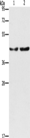 Anti-CBX6 Rabbit Polyclonal Antibody