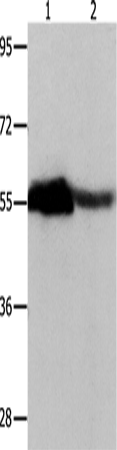Anti-CBX2 Rabbit Polyclonal Antibody