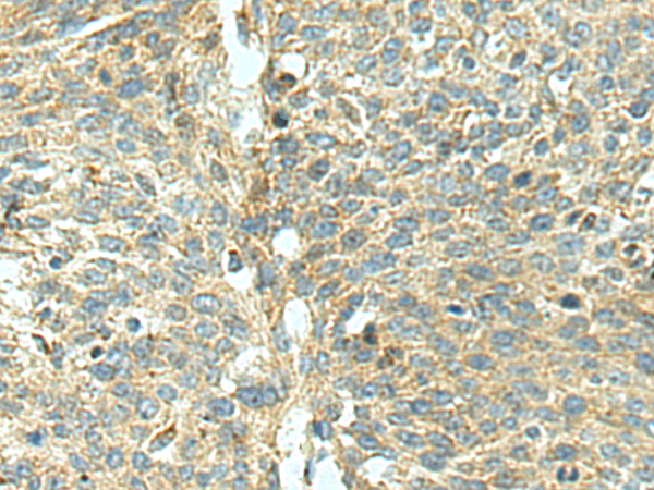 Anti-Dectin-1 Rabbit Polyclonal Antibody
