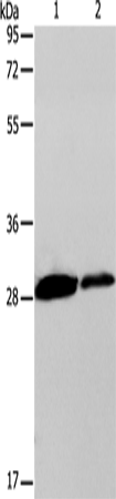 Anti-Dectin-1 Rabbit Polyclonal Antibody