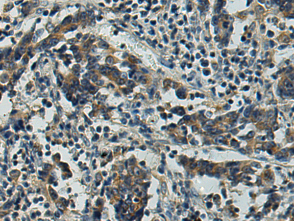 Anti-CDC20 Rabbit Polyclonal Antibody