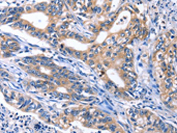 Anti-CDK2 Rabbit Polyclonal Antibody