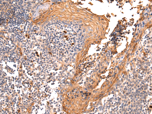 Anti-CD66b Rabbit Polyclonal Antibody