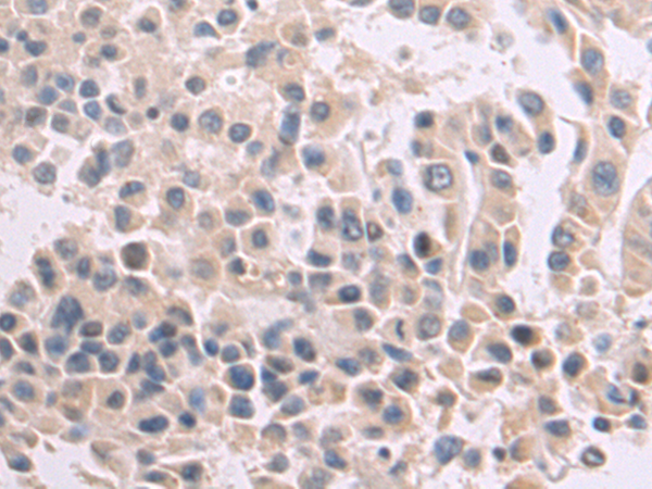 Anti-CLEC1 Rabbit Polyclonal Antibody
