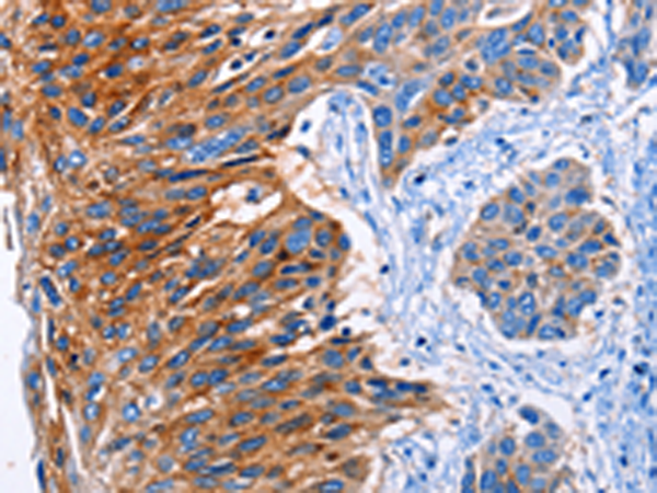 Anti-CLEC2B Rabbit Polyclonal Antibody