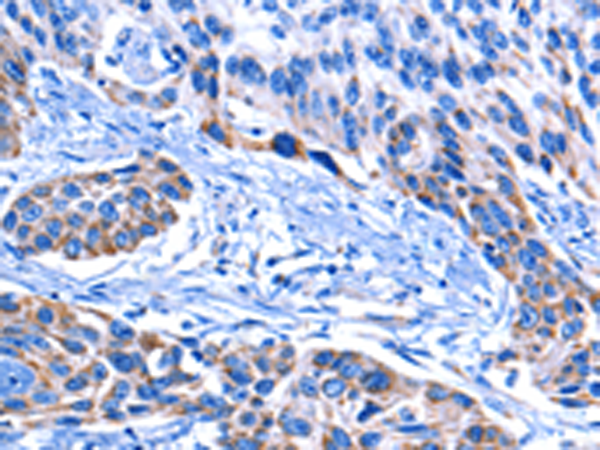 Anti-CNGA2 Rabbit Polyclonal Antibody