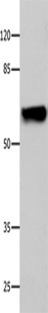 Anti-CNGA2 Rabbit Polyclonal Antibody