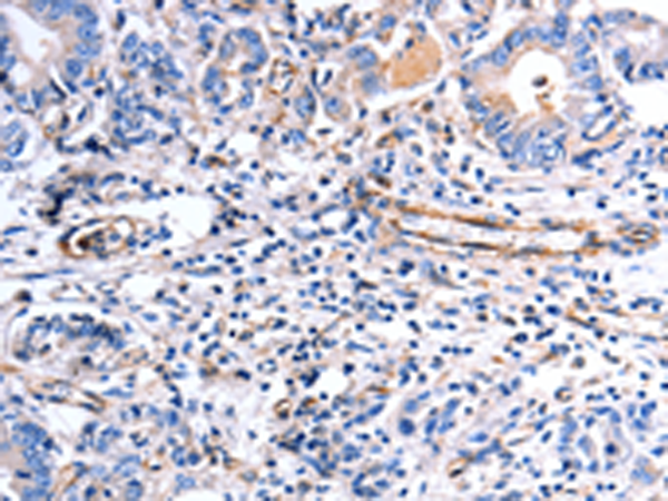 Anti-COX11 Rabbit Polyclonal Antibody