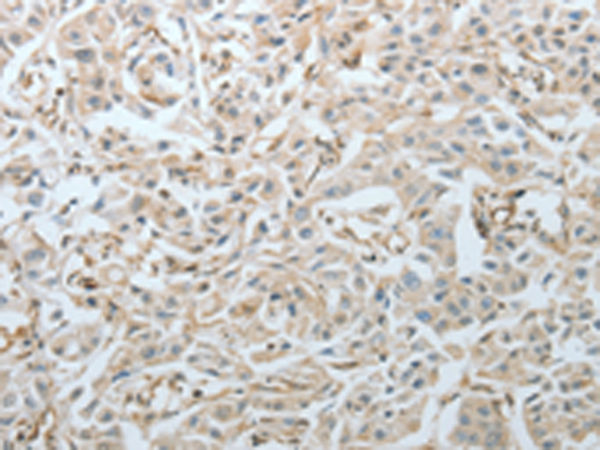 Anti-CRMP1 Rabbit Polyclonal Antibody