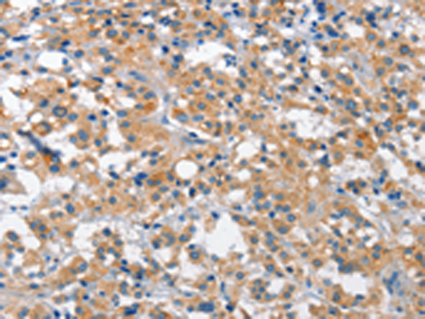 Anti-Cullin 7 Rabbit Polyclonal Antibody