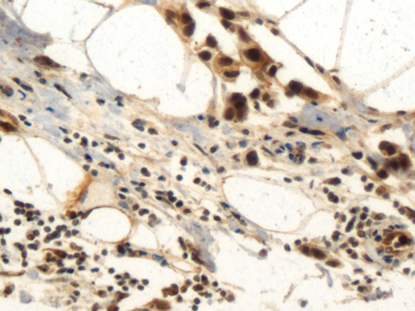 Anti-Cyclin A1 Rabbit Polyclonal Antibody