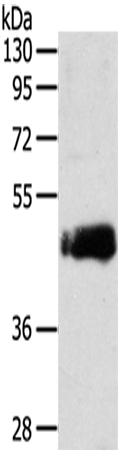Anti-SDCCAG3 Rabbit Polyclonal Antibody