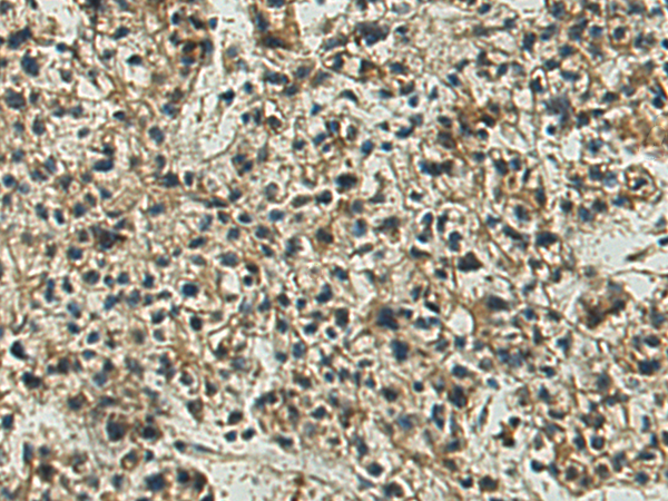 Anti-CLECSF6 Rabbit Polyclonal Antibody