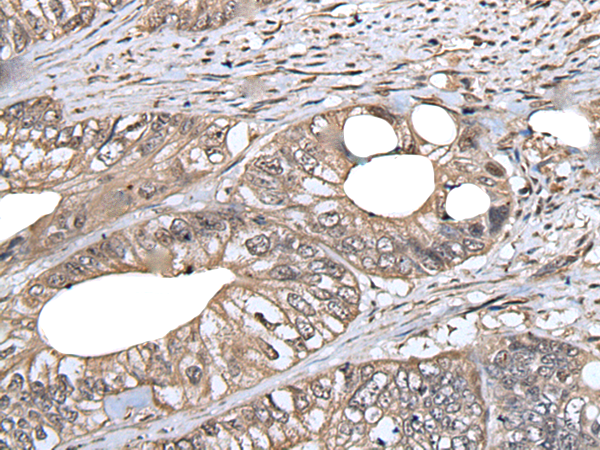 Anti-DLK1 Rabbit Polyclonal Antibody