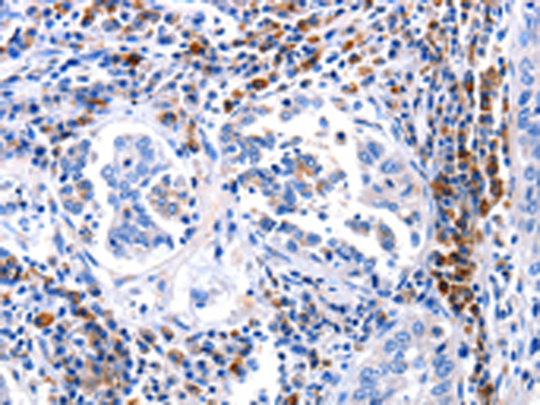 Anti-DOK3 Rabbit Polyclonal Antibody