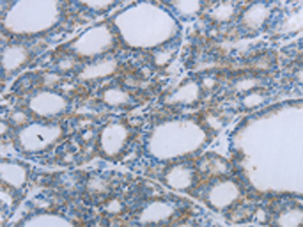 Anti-EGFL7 Rabbit Polyclonal Antibody