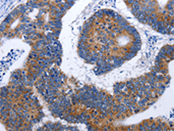 Anti-Elongation factor 1 gamma Rabbit Polyclonal Antibody