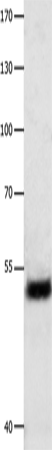Anti-Elongation factor 1 gamma Rabbit Polyclonal Antibody