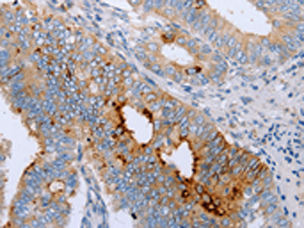 Anti-ENPP6 Rabbit Polyclonal Antibody