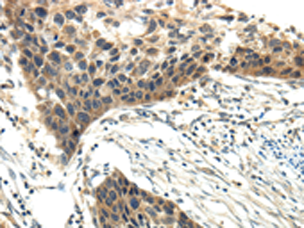 Anti-EFNA3 Rabbit Polyclonal Antibody