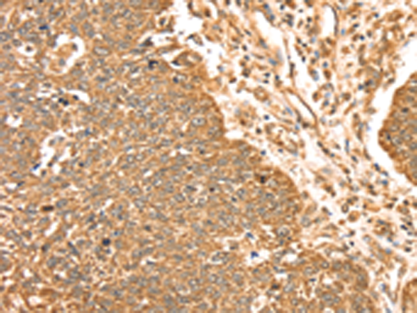 Anti-ERK5 Rabbit Polyclonal Antibody