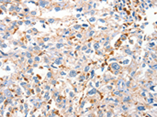Anti-DUSP14 Rabbit Polyclonal Antibody