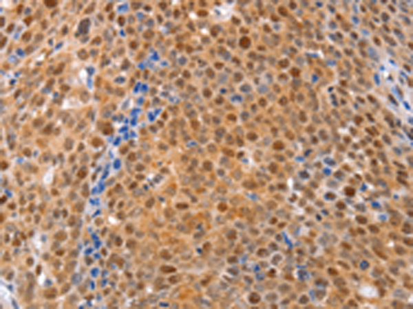 Anti-DUSP4 Rabbit Polyclonal Antibody