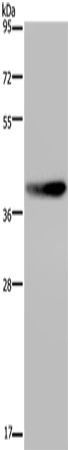 Anti-DUSP4 Rabbit Polyclonal Antibody