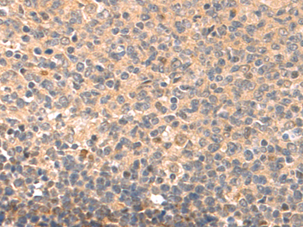 Anti-EDN3 Rabbit Polyclonal Antibody