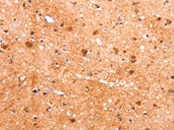 Anti-BLBP Rabbit Polyclonal Antibody