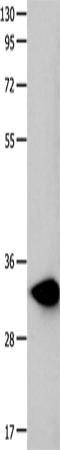 Anti-FOXS1 Rabbit Polyclonal Antibody