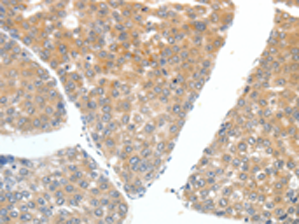 Anti-FSHR Rabbit Polyclonal Antibody