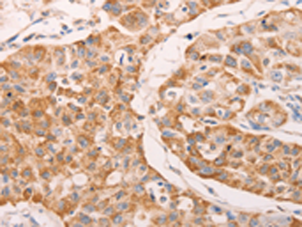 Anti-GNA11 Rabbit Polyclonal Antibody