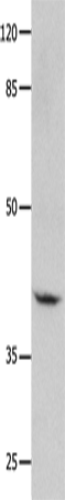 Anti-GNA11 Rabbit Polyclonal Antibody