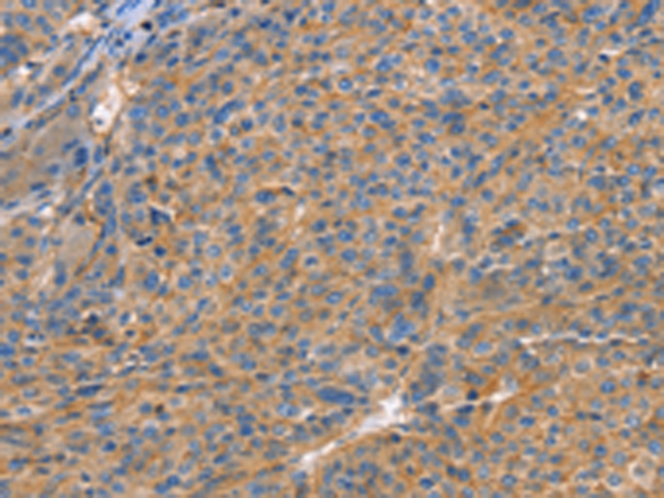 Anti-GNB1 Rabbit Polyclonal Antibody